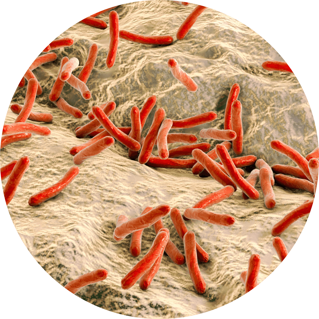 Tuberculosis image circular